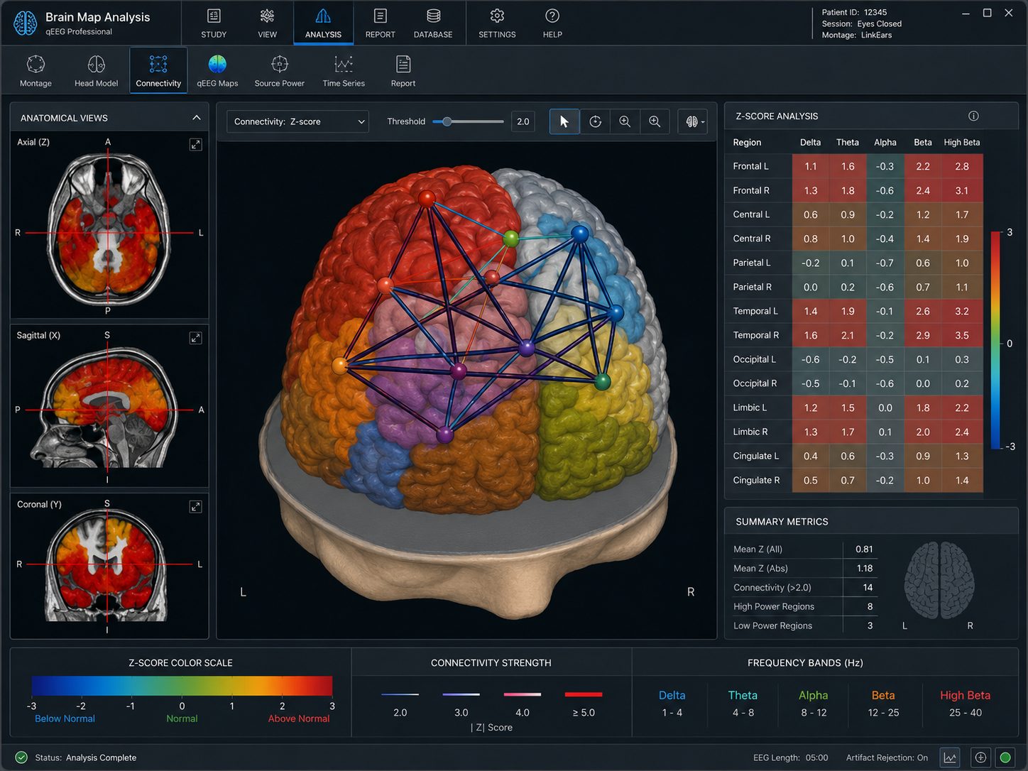 Brain Map Z-Score