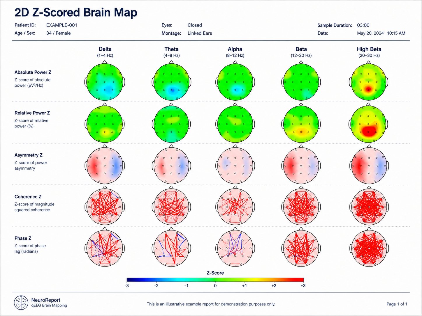 brain-map-2d-zscored